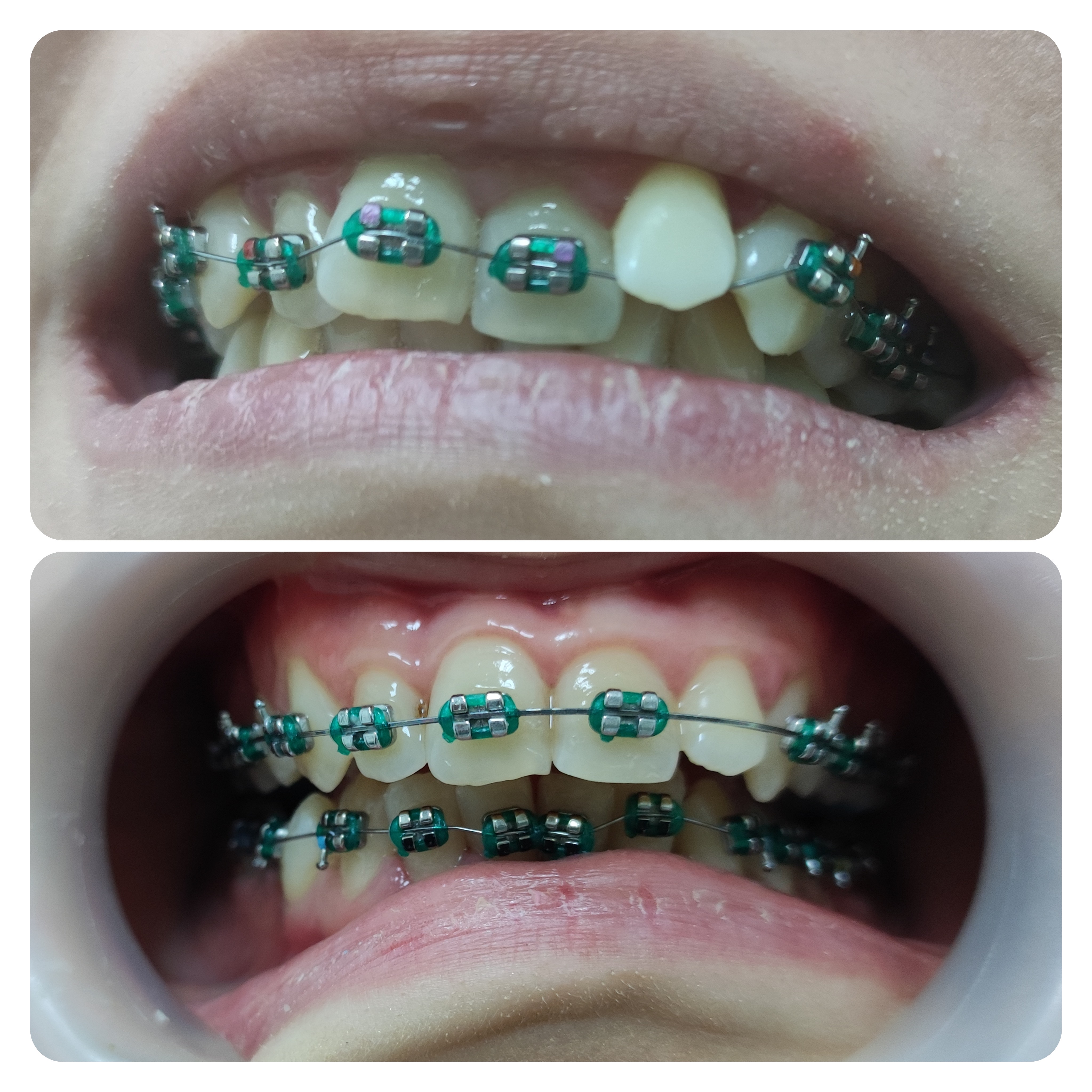Dental work 8
